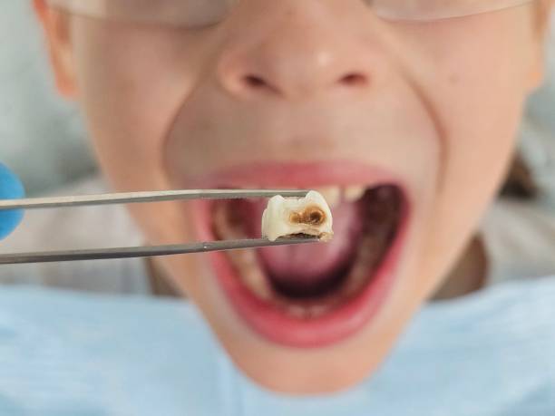 Best Emergency Dental Services for Seniors in Port Huron, MI